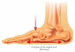 best nike for flat feet 2021