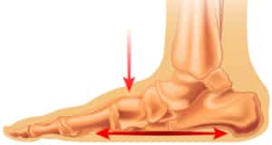 flat feet flat feet