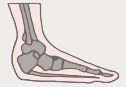 best shoe inserts for overpronation