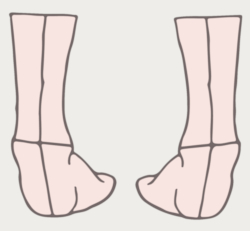 best shoe inserts for supination