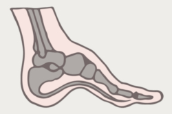 best shoe inserts for supination