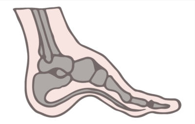 hoka shoes for high arches