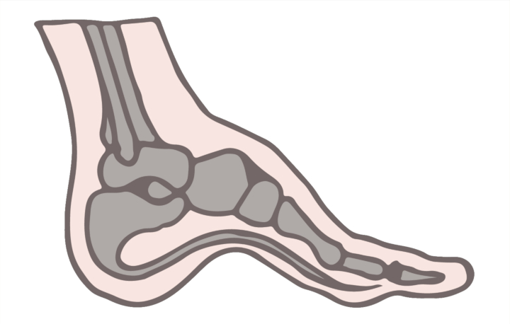 hoka shoes for high arches